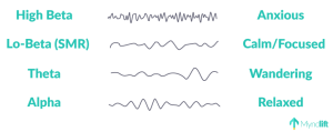 Brainwaves neurofeedback